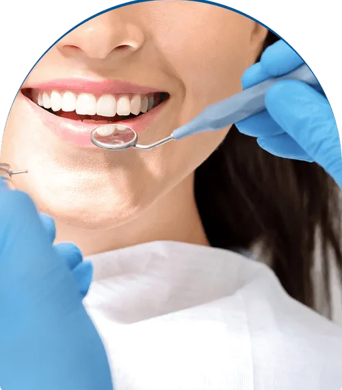 Teeth Whitening Dentist vs Store Bought Kits: Which Option Gives Better Results?